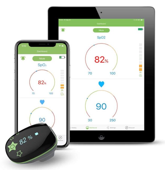 Bild zu ViATOM Kinderpulsoximeter (misst Sauerstoffgehalt, -Sättigung und Puls, per App und am Gerät) für 99,99€